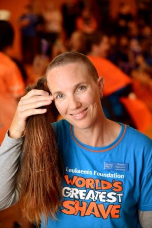 Scalped for a cause