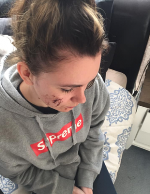 Woman fights off attacker