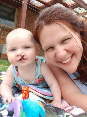 Surgery cancelled for six month old